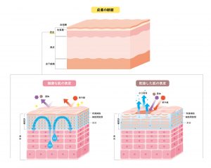 肌の表皮　皮膚の構造　肌図　美容